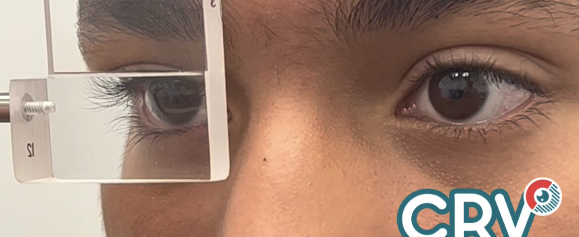 OPTOMETRIA, TERAPIA VISUAL, ORTOPTICA