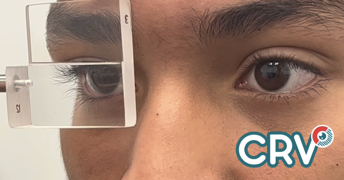 OPTOMETRIA, TERAPIA VISUAL, ORTOPTICA